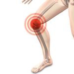 Cryoneurolysis for management of chronic pain in knee osteoarthritis